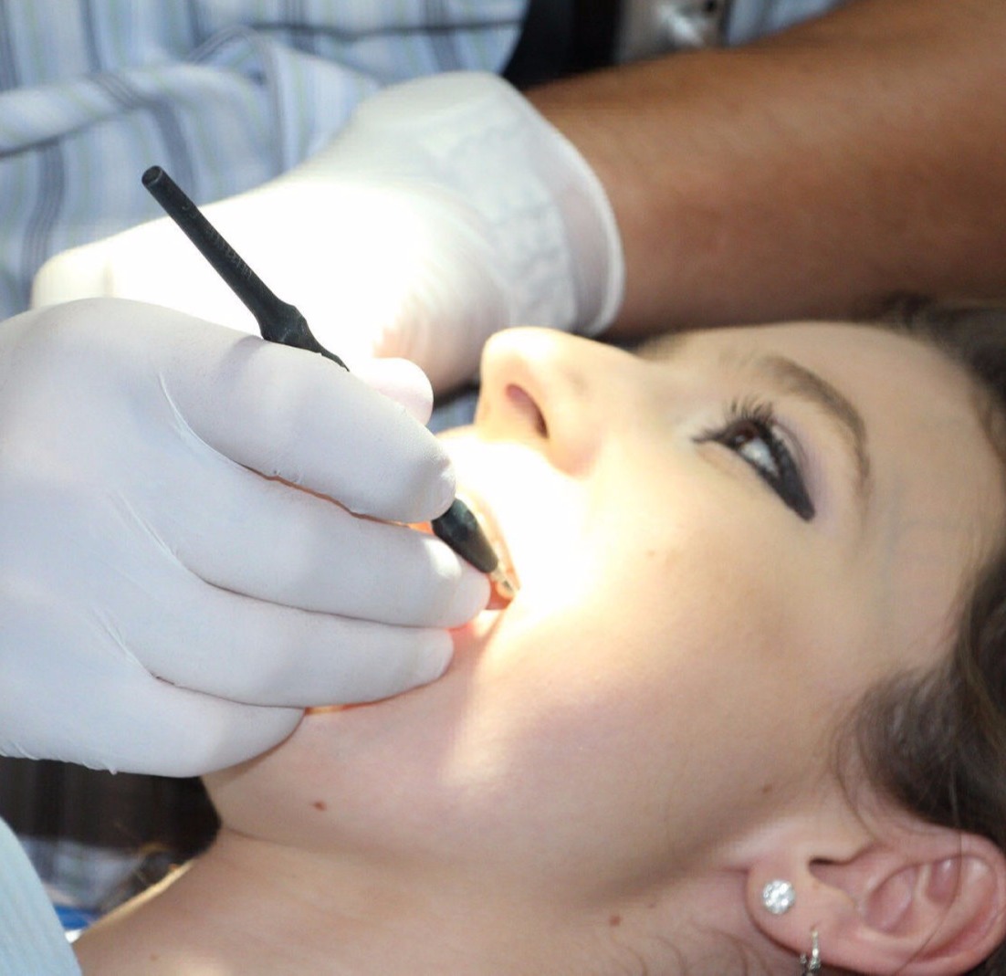 Implant dentaire Paris